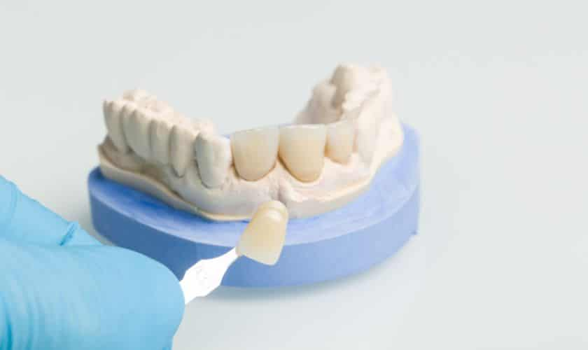Complete Dental Restoration: Revitalizing Oral Health and Confidence