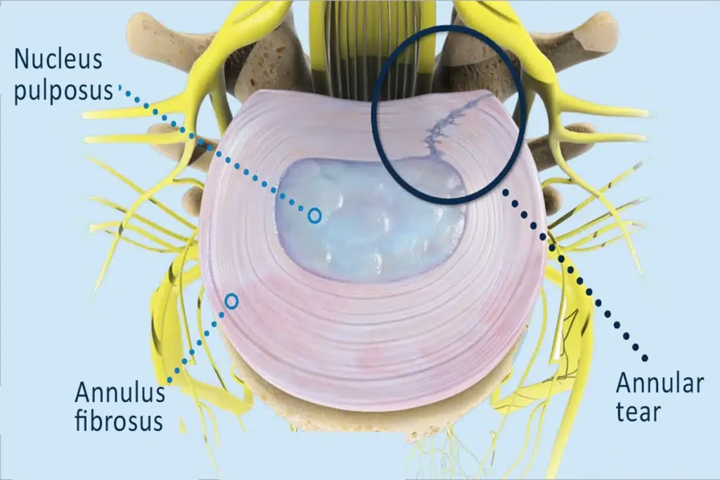 What Is an Annular Throbber and How Does It Work