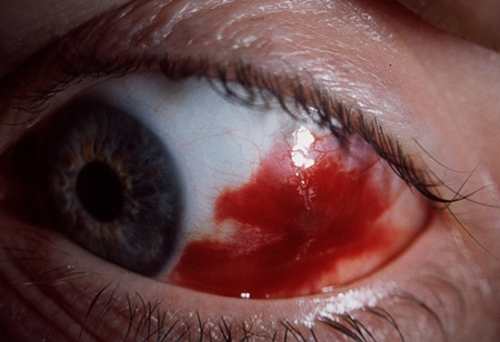 Traumatic Injuries That Cause Vision Problems