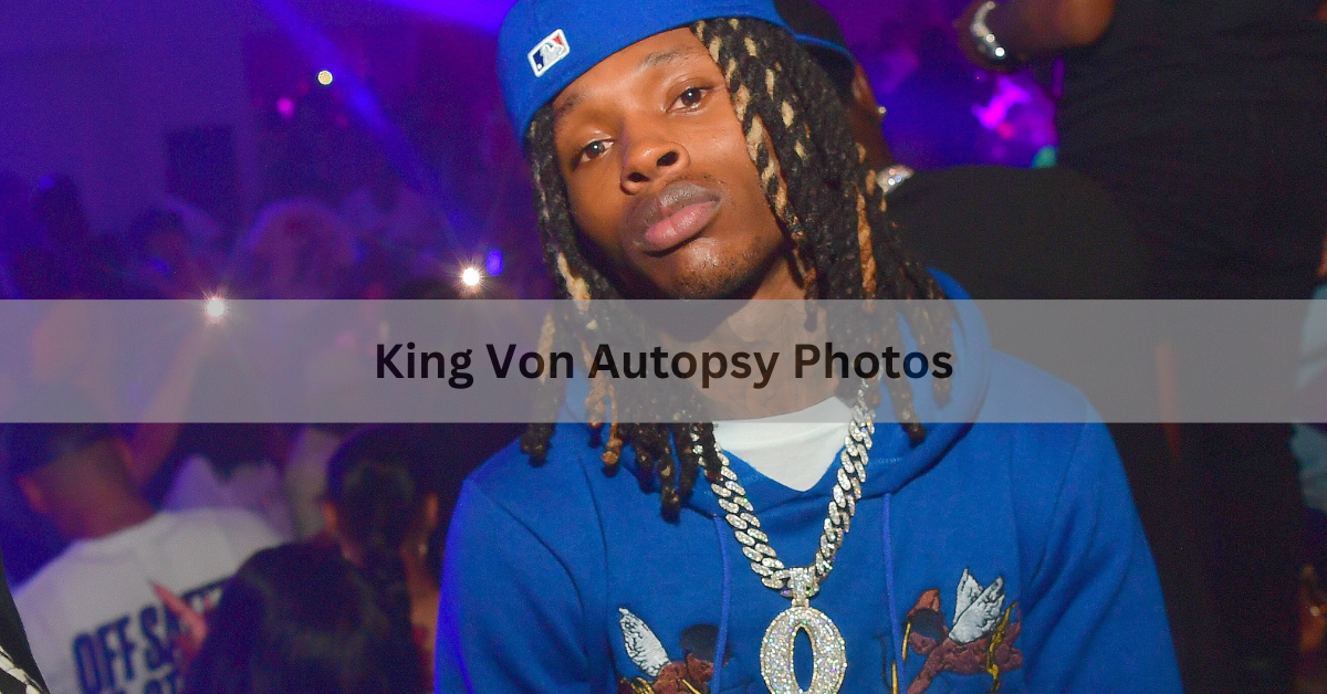 King Von Autopsy Photos